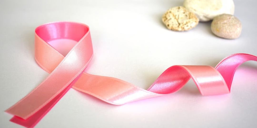 Development of an image-based AI model for breast cancer risk prediction